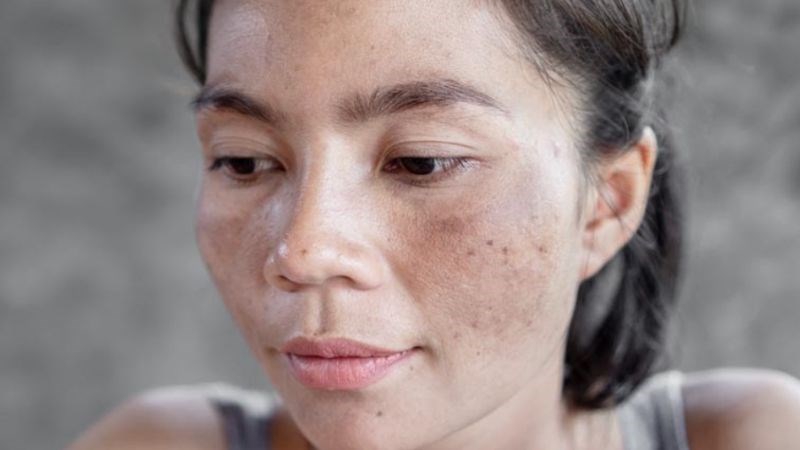 Da nám phù hợp để sử dụng Luma Nano Dark Spot Remover