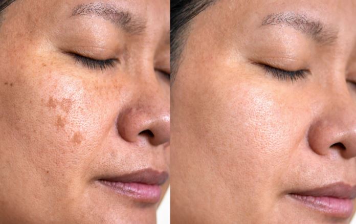 Kết quả sau 80 ngày sử dụng liên tục